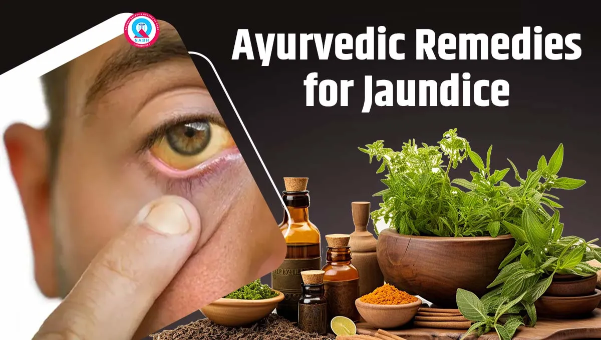 ayurvedic-remedies-for-jaundice